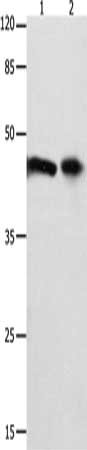 FOXL1 Antibody