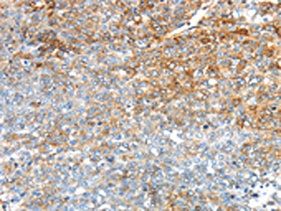 TRIM47 Antibody