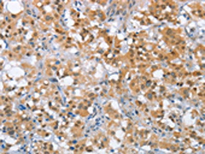 MLH1 Antibody