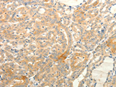TPH1 Antibody