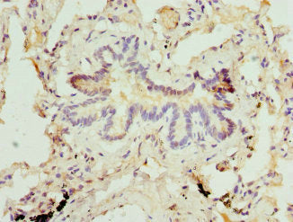 MBTPS1 Antibody