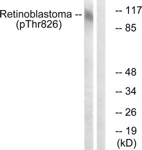 Phospho-RB1 (Thr826) Antibody