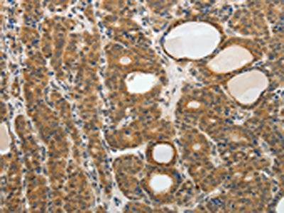 RARA Antibody