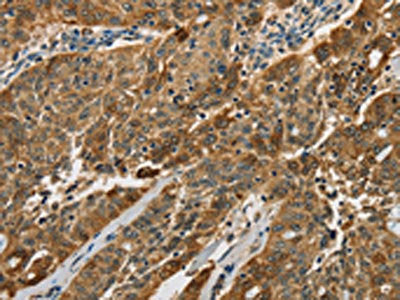 CTSE Antibody