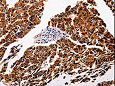 IL1RAP Antibody