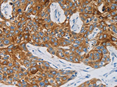 NDRG4 Antibody