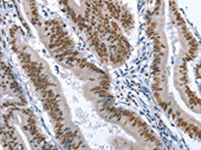 GNRH1 Antibody