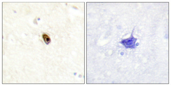 Phospho-AURKC (Thr236/202) Antibody