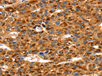 TLN1 Antibody