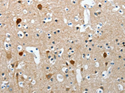 RCAN2 Antibody