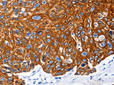NFATC1 Antibody