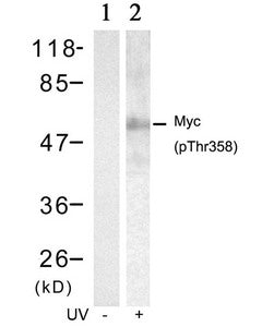 Phospho-MYC (Thr358) Antibody