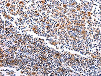 HDAC4 Antibody