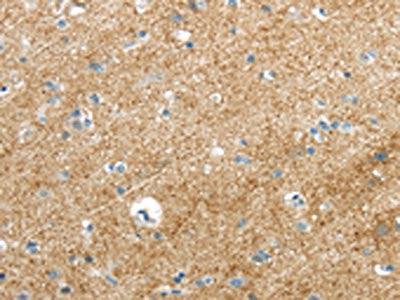 VAMP1 Antibody