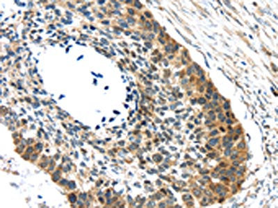 GRIN2A Antibody