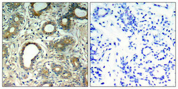 Phospho-PTPN11 (Tyr580) Antibody