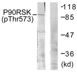 Phospho-RPS6KA1 (Thr573) Antibody