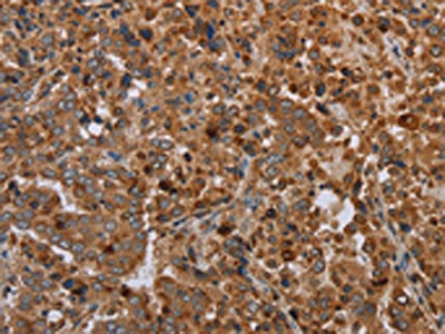 REG3A Antibody