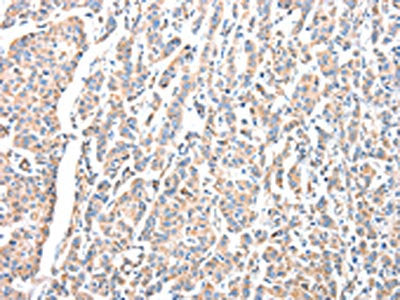 ADA Antibody