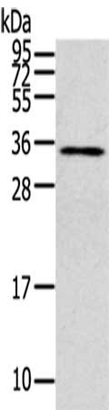 CLIC4 Antibody