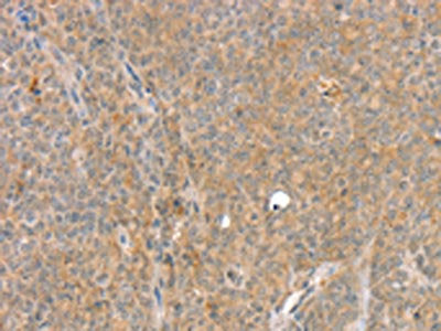 SLC8A3 Antibody