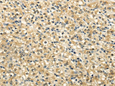 NSD1 Antibody