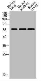 Acetyl-HNF4A/HNF4G (Lys127/79) Antibody