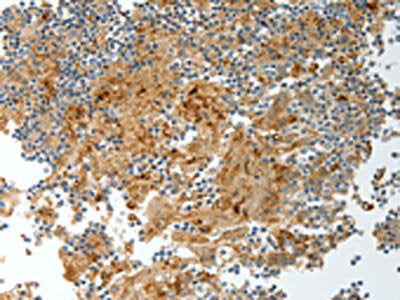 PRCP Antibody