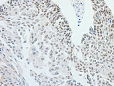 RPS6KB1 Antibody