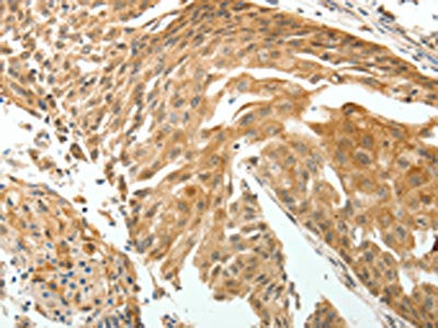 ROCK2 Antibody