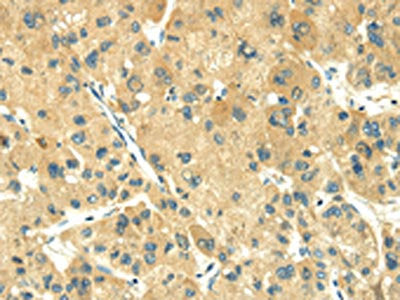 TRIM10 Antibody