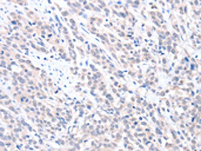 ABLIM1 Antibody