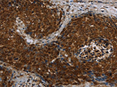 CERS5 Antibody