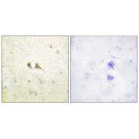 FASLG Antibody