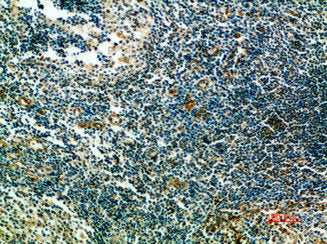 ST6GAL1 Antibody