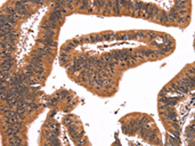 FAIM Antibody