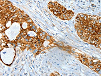 KRT18 Antibody