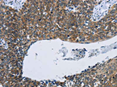 KPNB1 Antibody