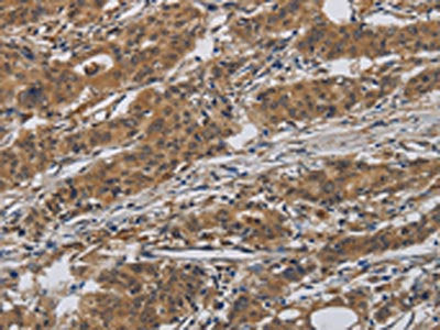 INPPL1 Antibody