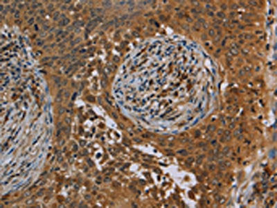 OSM Antibody