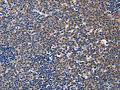 CCR6 Antibody