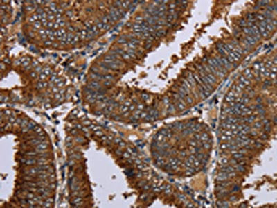 OCC1 Antibody