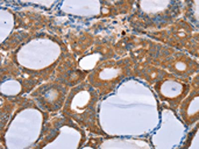 NOS2 Antibody