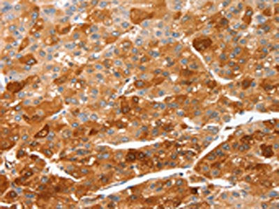 CIDEC Antibody