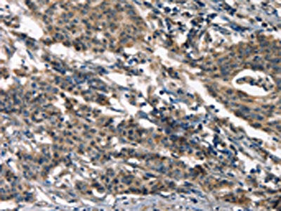 DEFA5 Antibody