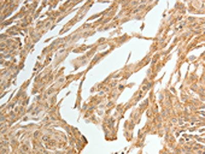 TWIST1 Antibody