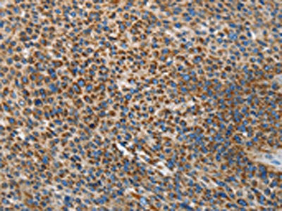 UPF1 Antibody