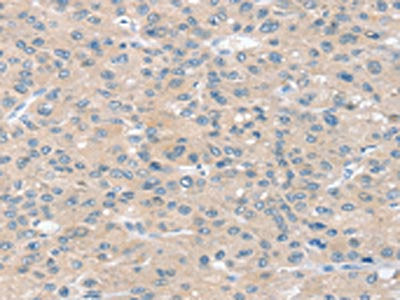 SLIT2 Antibody