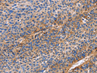 ITGB1 Antibody
