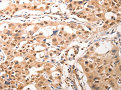 CDC6 Antibody